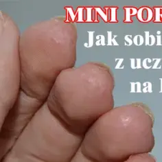 Uczulenie na hybrydę - jak rozpoznać objawy i co robić?