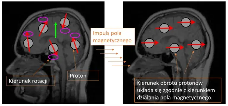 Zdjęcie Rezonans magnetyczny z hybrydami - czy to bezpieczne? Wyjaśniamy